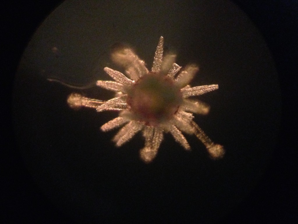 Juvenile sea urchin (Strongylocentrotus purpuratus), 11 March 2015. ©Allison J. Gong