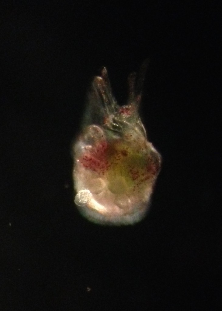 Metamorphosing larva of Strongylocentrotus purpuratus, photographed with dark-field lighting, 8 March 2015.  ©Allison J. Gong