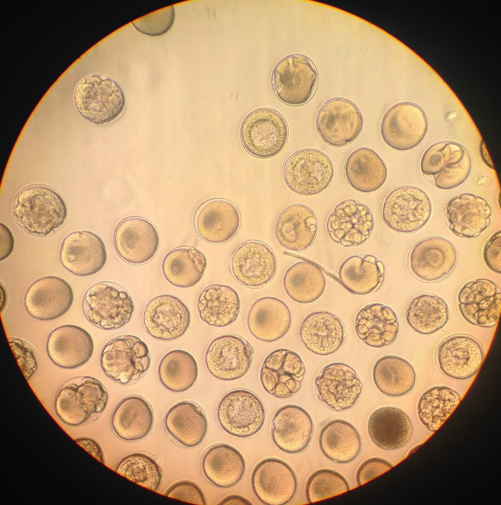 Embryos of Pisaster ochraceus, age 24 hrs. 3 June 2015. © Allison J. Gong