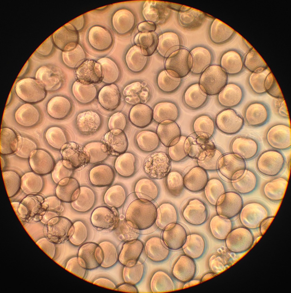 24-hr embryos of Pisaster ochraceus, 3 June 2015. © Allison J. Gong