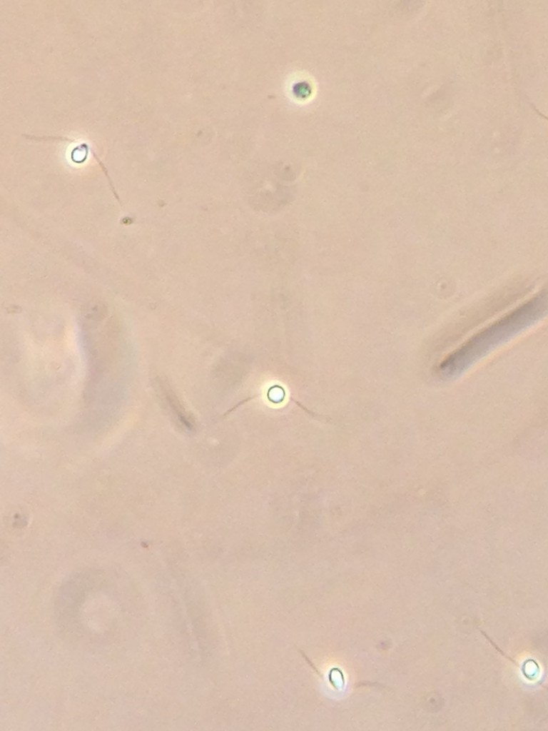 Biflagellated gametes of Ulva sp., 11 June 2015. © Allison J. Gong