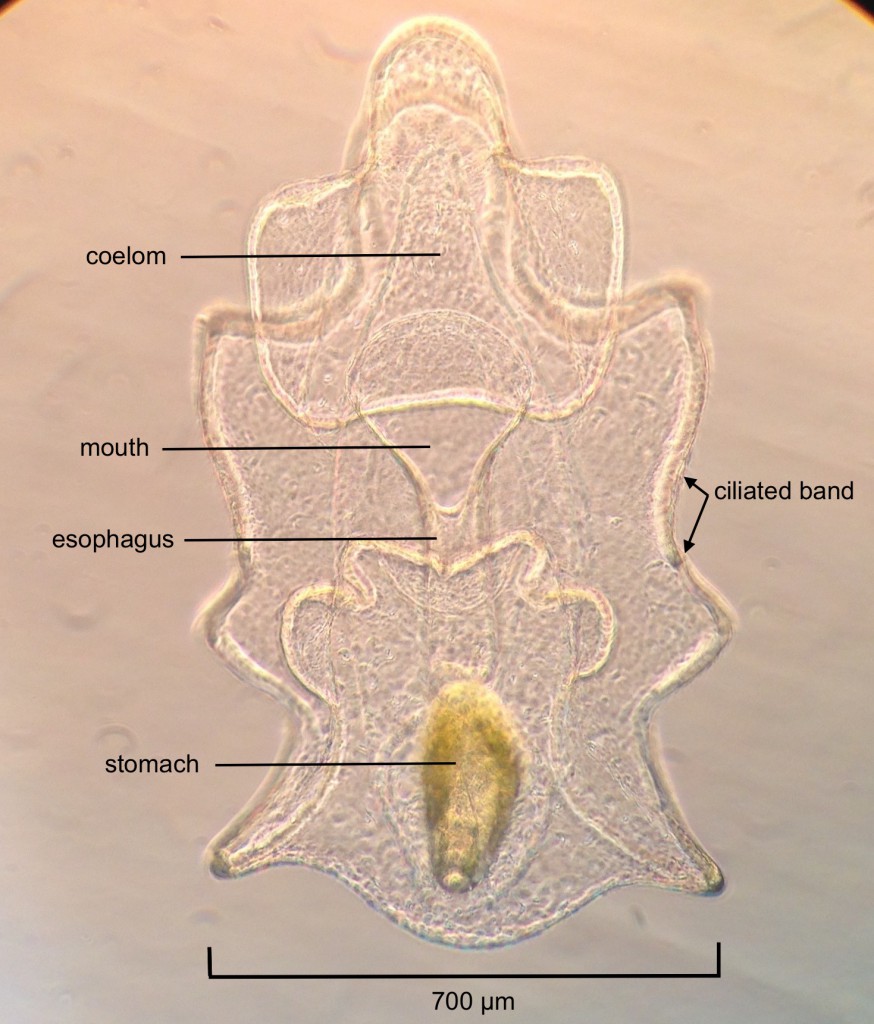 Brachiolaria larva of Pisaster ochraceus, age 17 days. 19 June 2015. © Allison J. Gong 