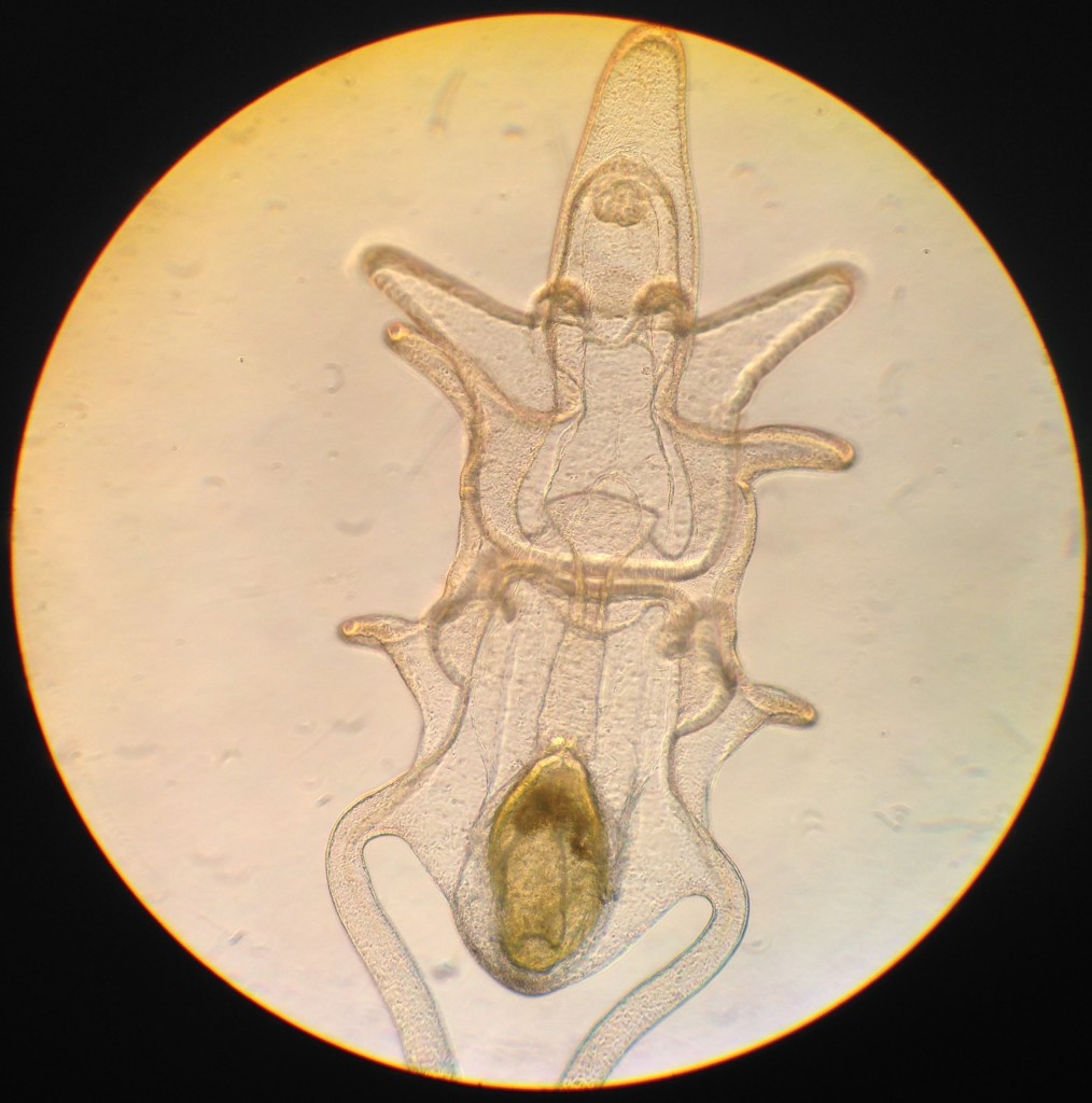 Brachiolaria larva of Pisaster ochraceus, age 24 days. 26 June 2015. © Allison J. Gong