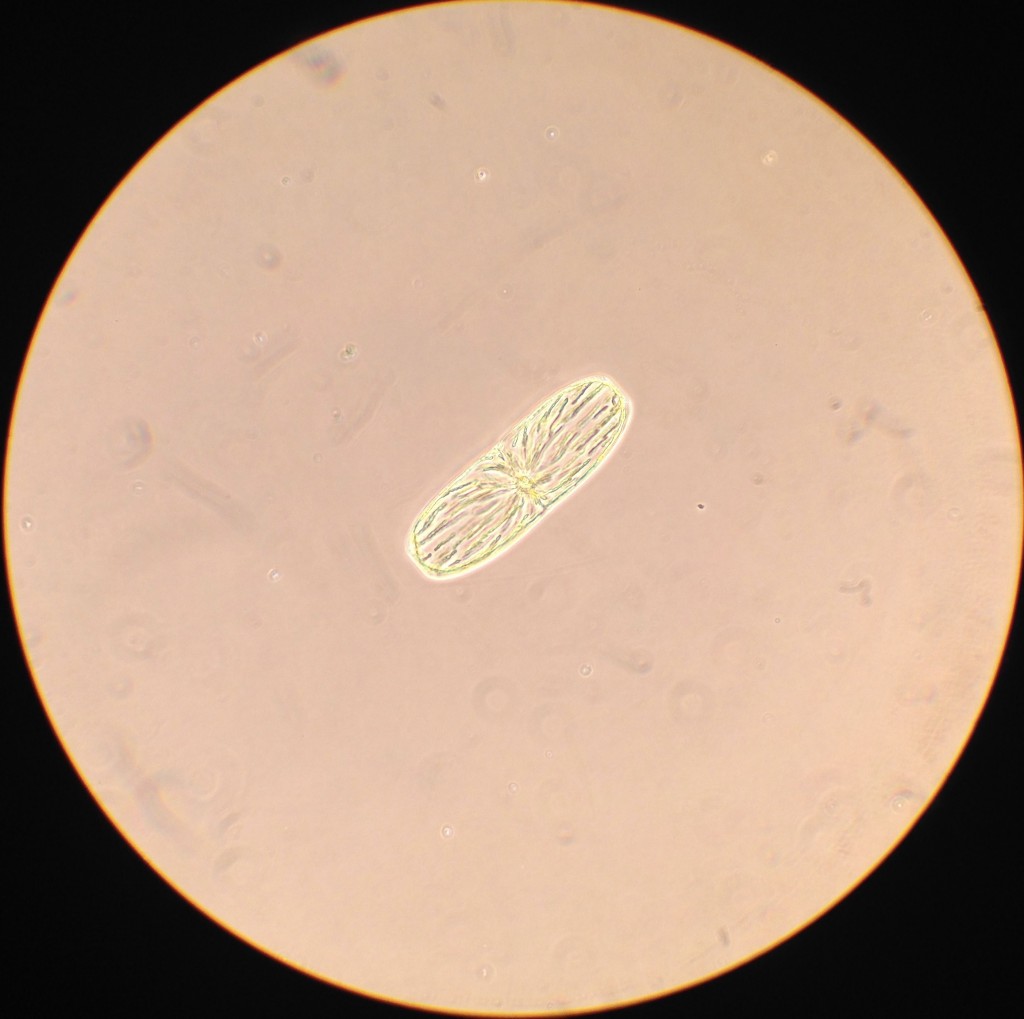 Mystery phytoplankter collected from a plankton tow off the Santa Cruz Municipal Wharf. 18 November 2015 © Allison J. Gong