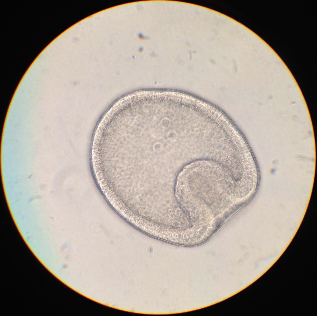 Almost-two-day-old embryo of Dermasterias imbricata. 24 February 2016 © Allison J. Gong