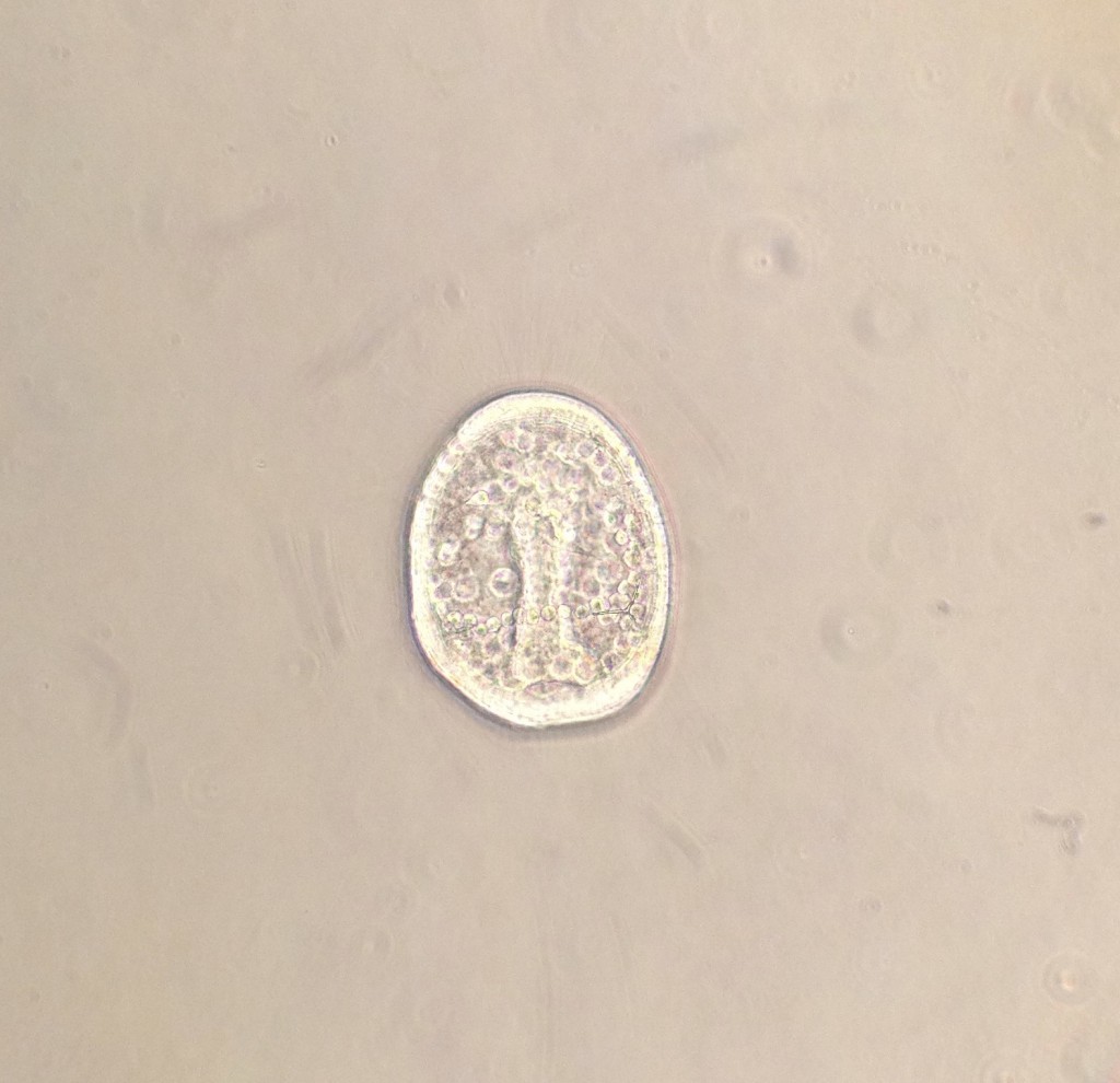 Gastrulating embryo of the sand dollar Dendraster excentricus, age 24 hrs. 24 March 2016 © Allison J. Gong