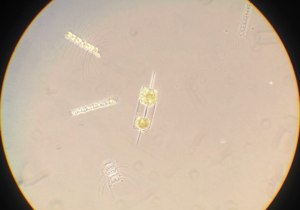 The diatoms Ditylum brightwellii and Chaetoceros spp. from a plankton tow collected from the Santa Cruz Wharf. 27 April 2016 © Allison J. Gong