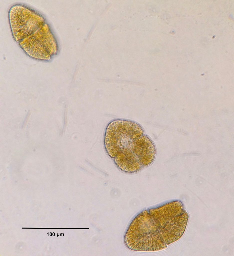 Living cells of the dinoflagellate Akashiwo sanguinea. 15 September 2016 © Allison J. Gong